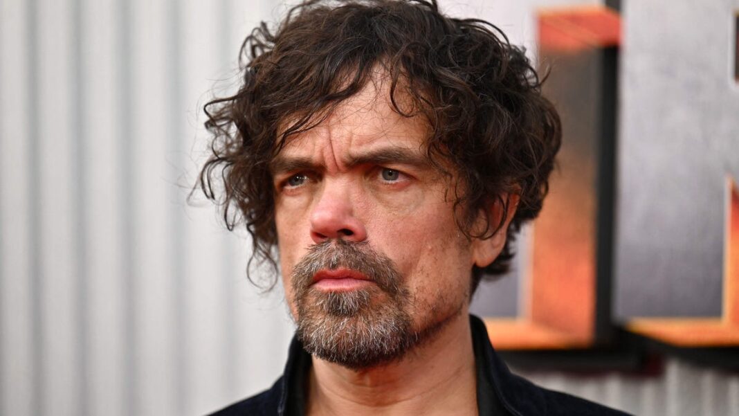 ‘Game of Thrones’ star Peter Dinklage has scar from being ‘kneed in head’ in ’90s punk band