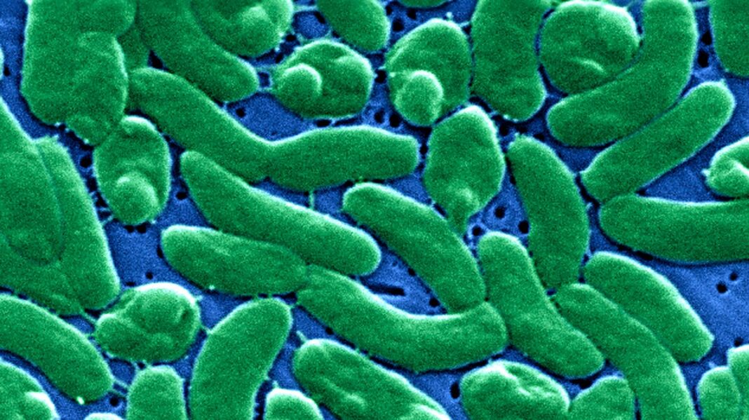 Flesh-eating bacteria cases rise to record level after hurricanes in Florida